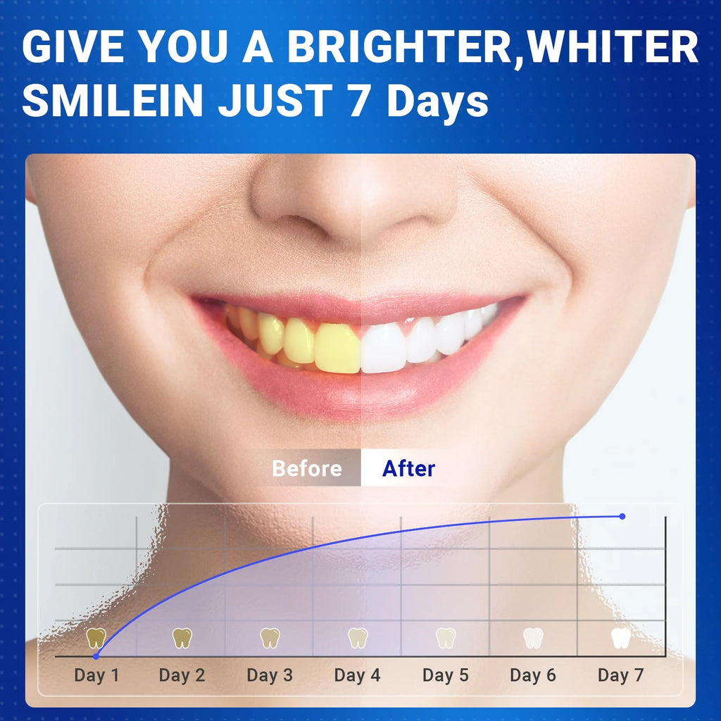 Teeth Whitening Strip - 56 Strips Professional and Safe Teeth Whitening Kit for Teeth Sensitive, Mint